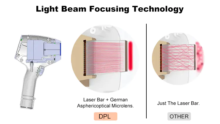 Diode Laser Hair Removal Equipment