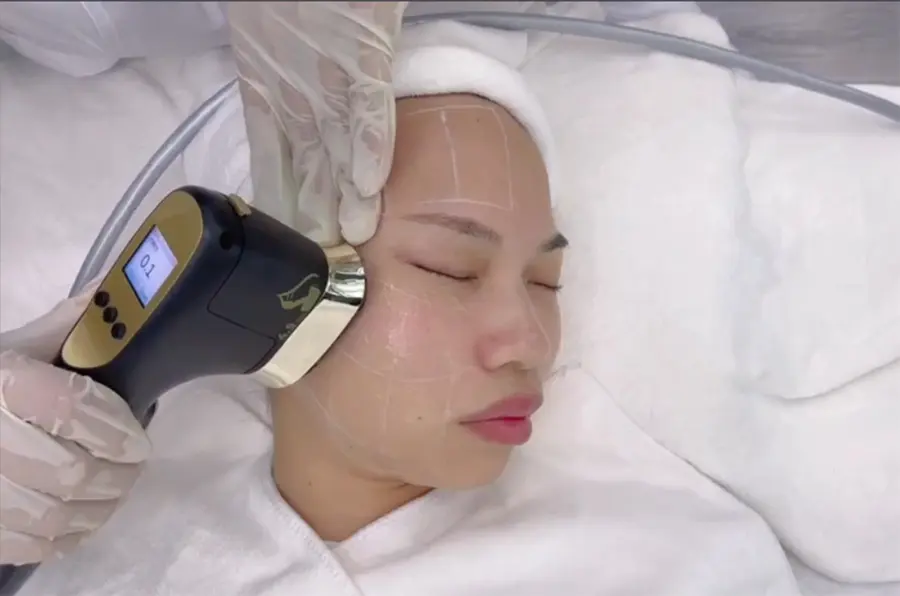 High Intensity Focused Ultrasound Skin Tightening