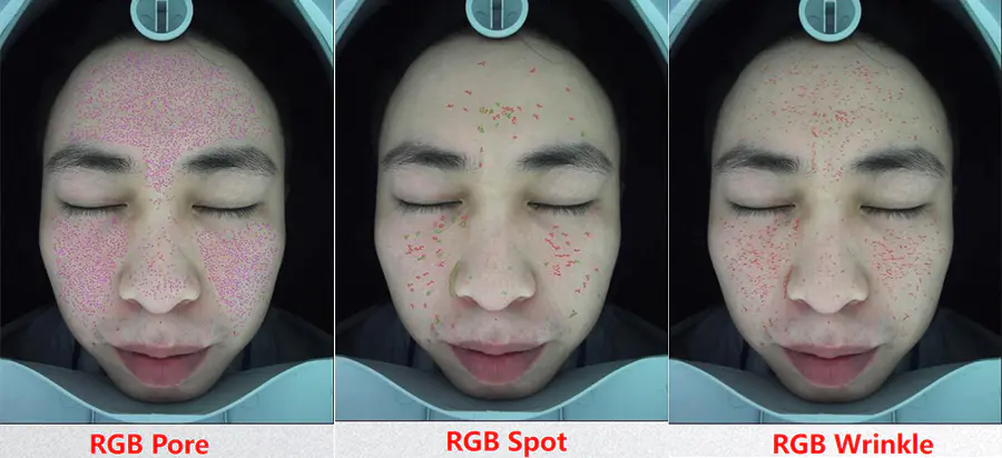 Skin Diagnostic