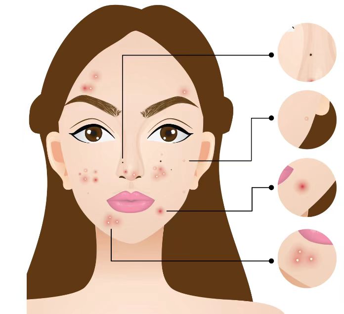 Skin Care Analyzer