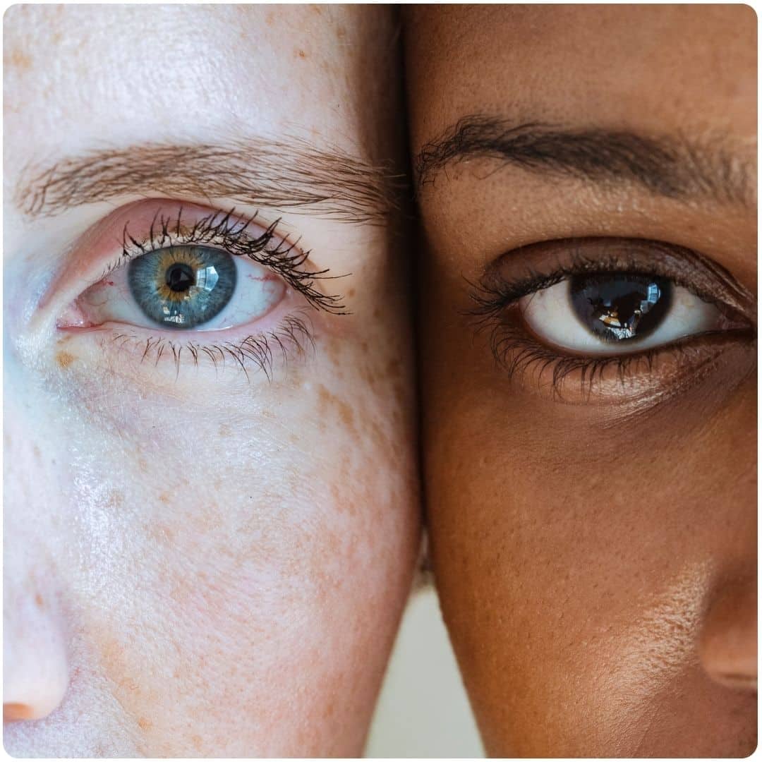 a woman with freckles and woman with clear skin