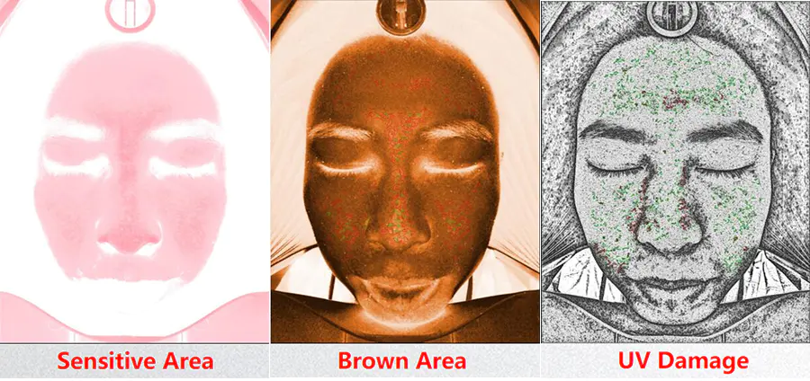 Skin Care Analysis