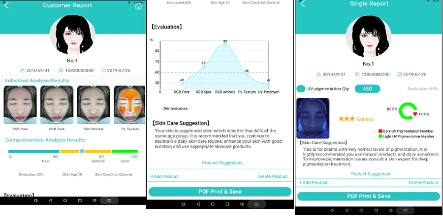 Skin Type Analysis