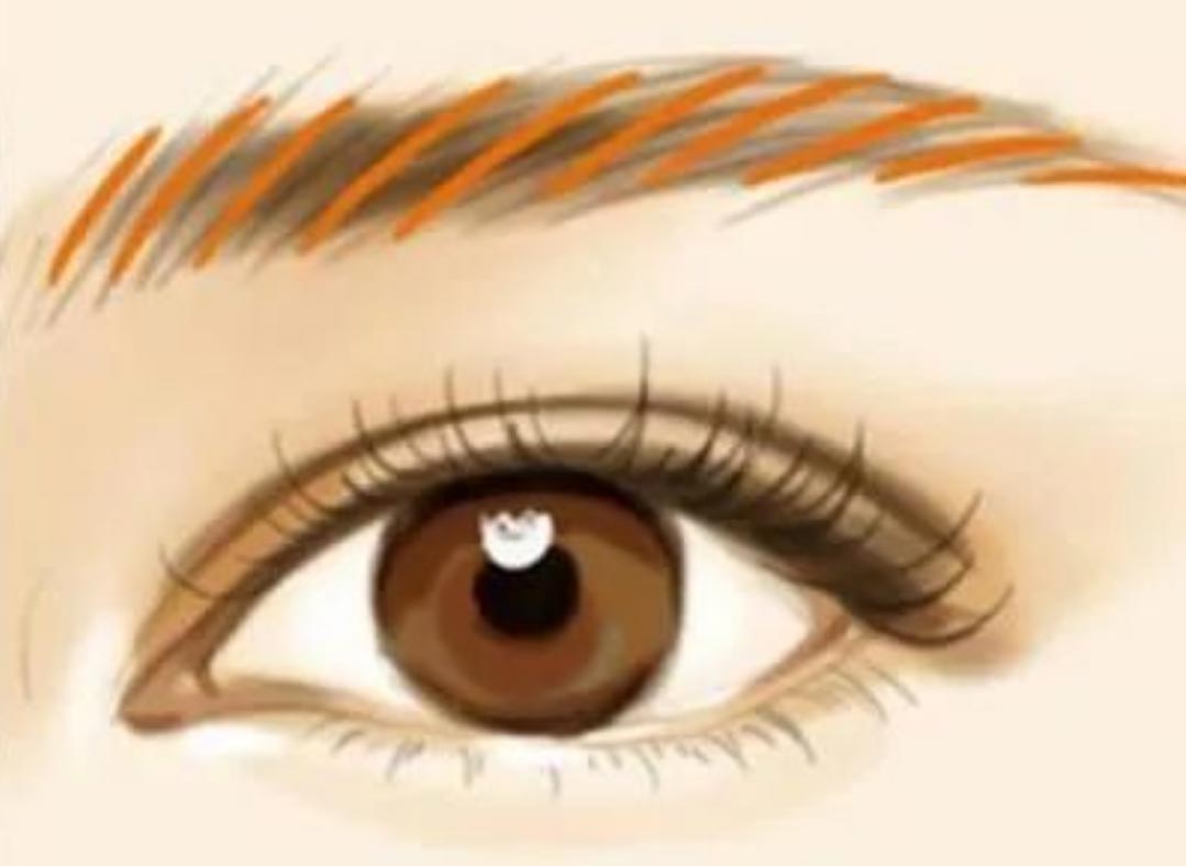 laser microblading removal