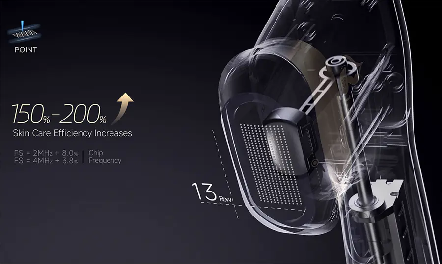 High Intensity Focused Ultrasound for Face