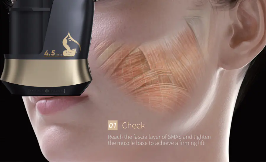 Hifu Therapy for Face