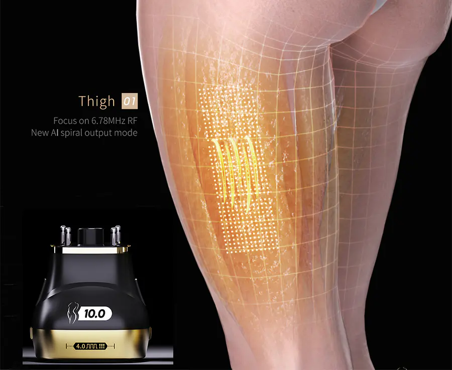 Hifu Body Contouring