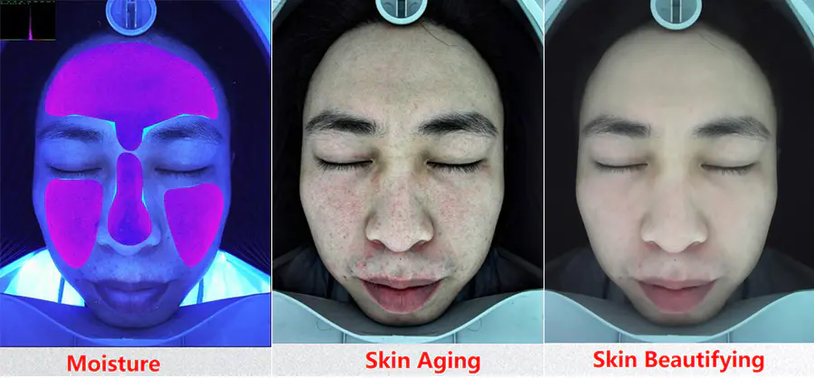 Face Mapping Skin Analysis