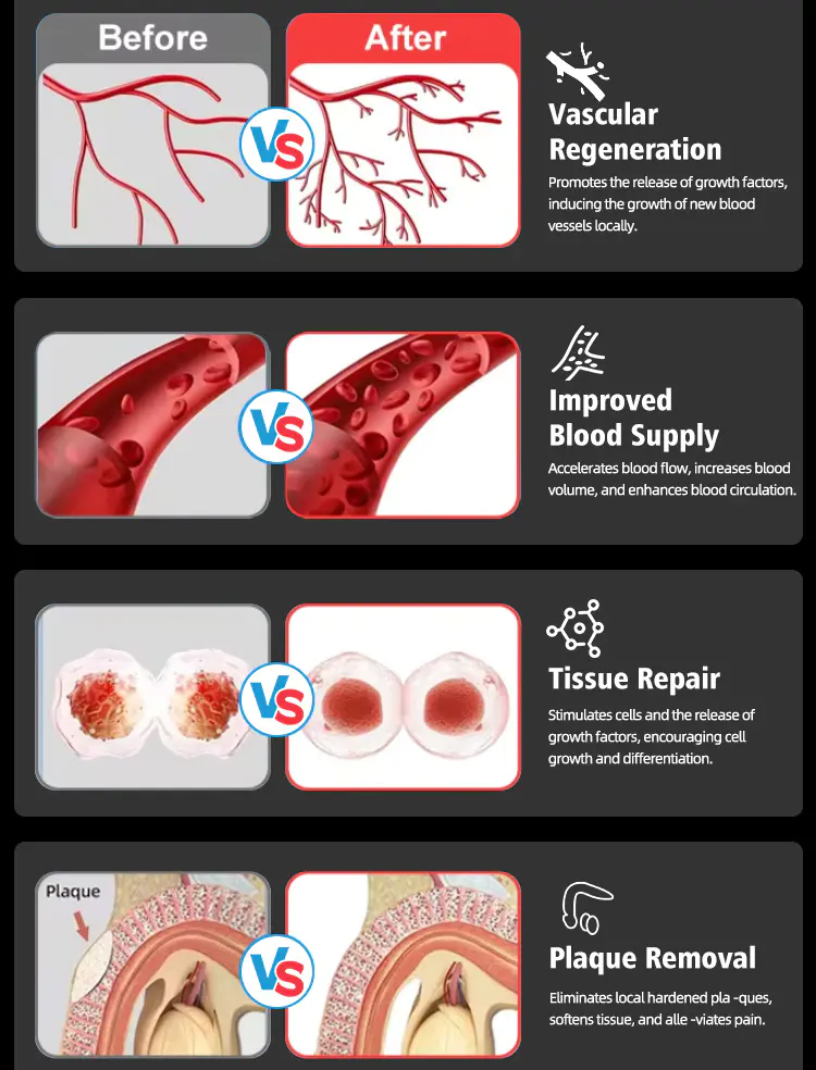 Eswt Treatment for Ed