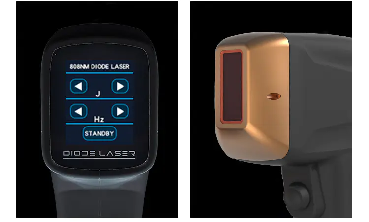 Commercial Laser Hair Removal Equipment
