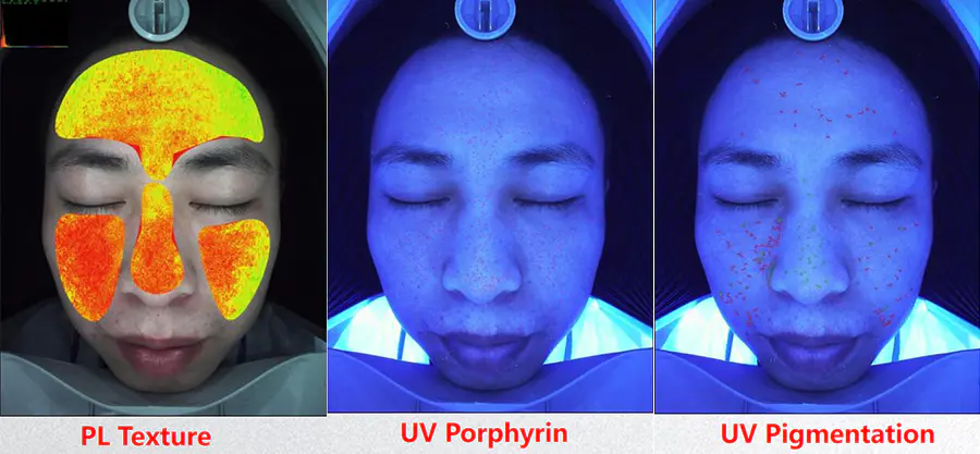 Clinique Skin Analysis